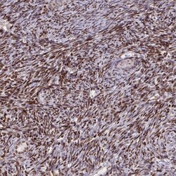 ZNF559 Antibody, Novus Biologicals:Antibodies:Primary Antibodies